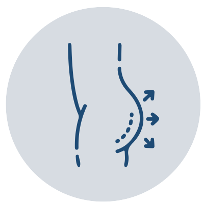 gluteos